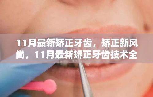 11月最新矫正牙齿技术评测，引领矫正新风尚的全面指南