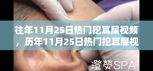 历年11月25日热门挖耳屎视频回顾，趋势解析与要点探讨