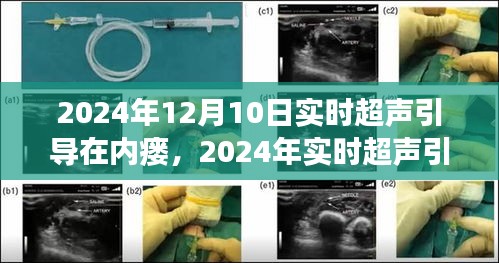 实时超声引导在2024年内瘘诊疗的最新应用
