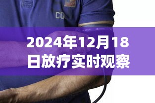 隐匿小巷深处的光疗守护者，放疗与血压监测的奇妙之旅纪实视频（附观看指南）