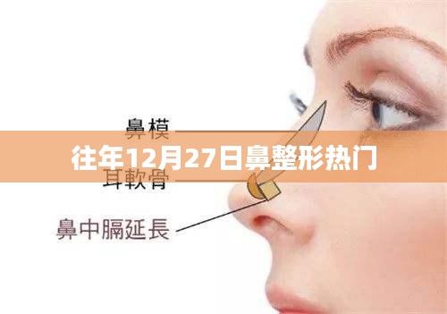 鼻整形热门趋势回顾，历年12月27日盘点