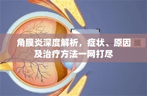 角膜炎深度解析，症状、原因及治疗方法一网打尽