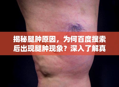 揭秘腿肿原因，为何百度搜索后出现腿肿现象？深入了解真相