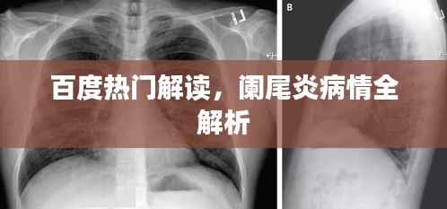 百度热门解读，阑尾炎病情全解析