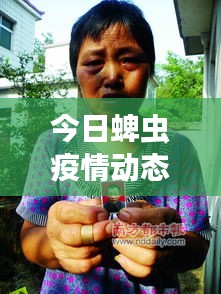 今日蜱虫疫情动态，最新消息关注与防控措施加强