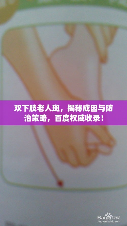 双下肢老人斑，揭秘成因与防治策略，百度权威收录！